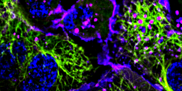 tub gfp bioimaging core picture