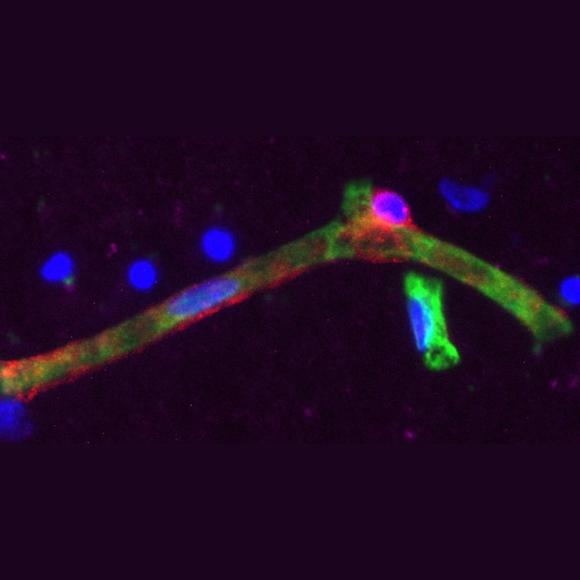 Human Brain Pericyte